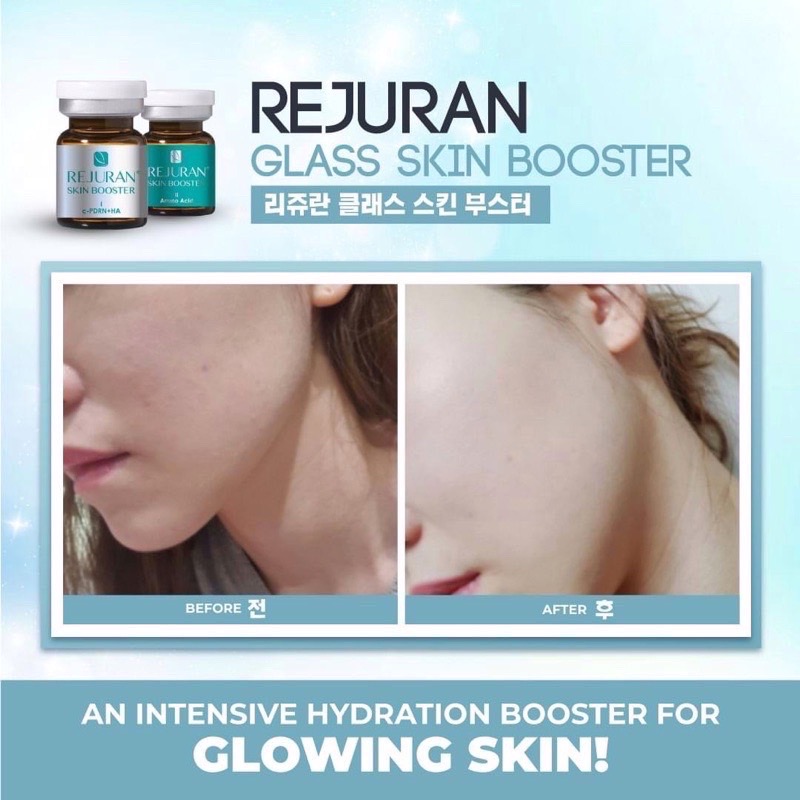 Rejurun Skin Booster