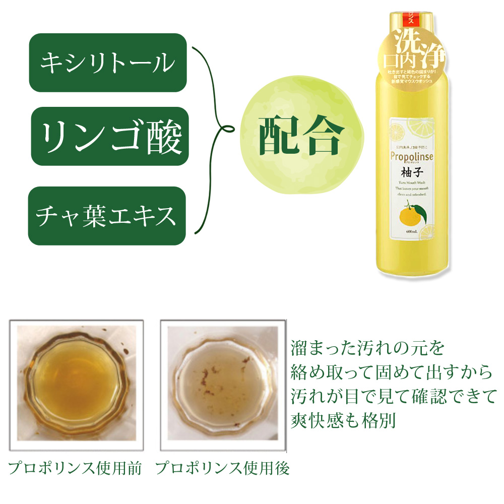 Propolinse mouthwash 2 น้ำยาบ้วนปาก ขนาด 150 ขวดเล็ก / 600ml ขวดใหญ่‼️ มีให้เลือก 3 สี