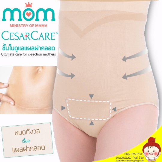 ชั้นในลดรอยแผลผ่าคลอด CesarCare Ultimate care for c-section mothers เทคโนโลยีจดสิทธิบัตรจากสหรัฐอเมริกา ยี่ห้อ Ministry of Mama