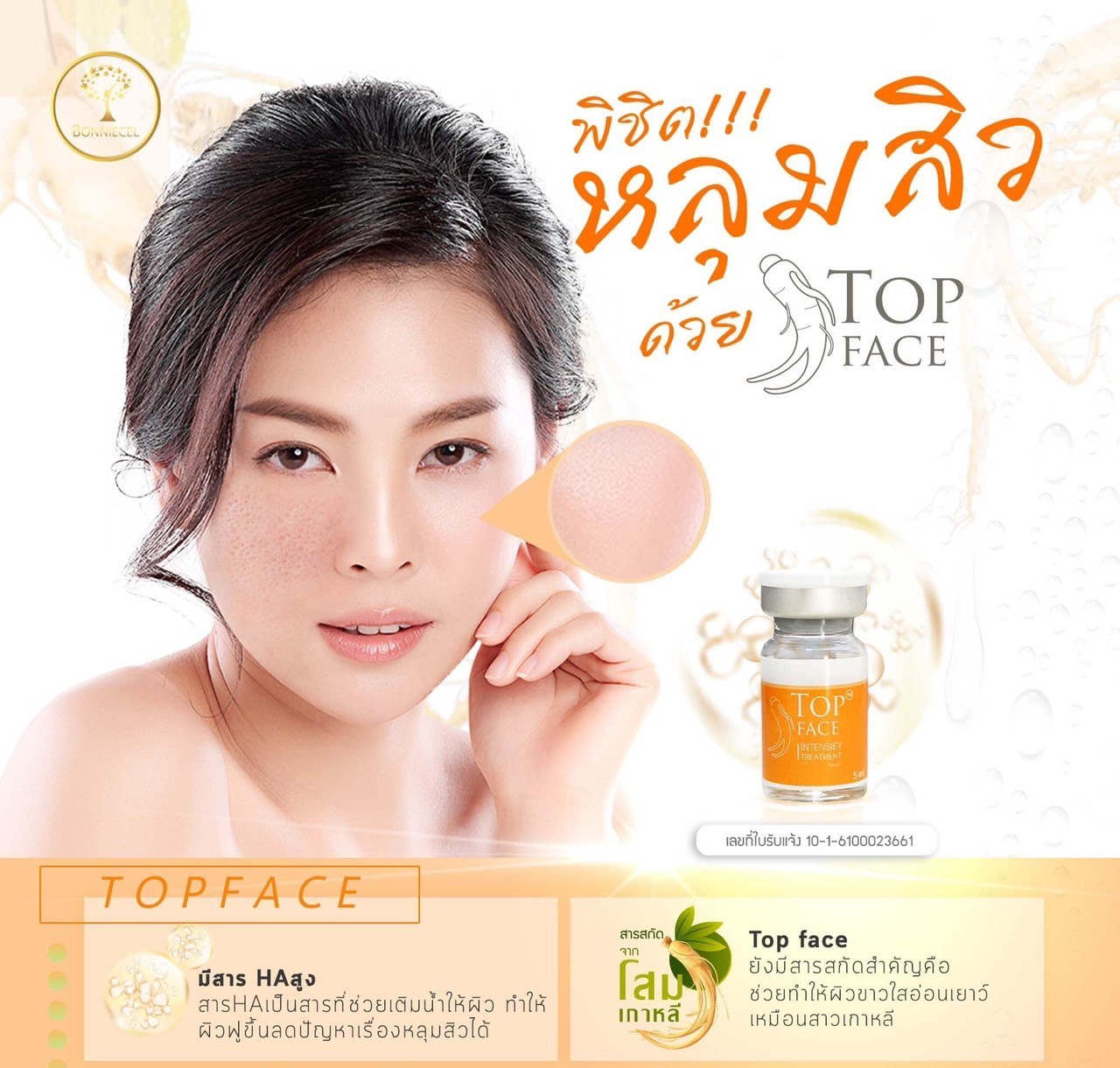 Top face