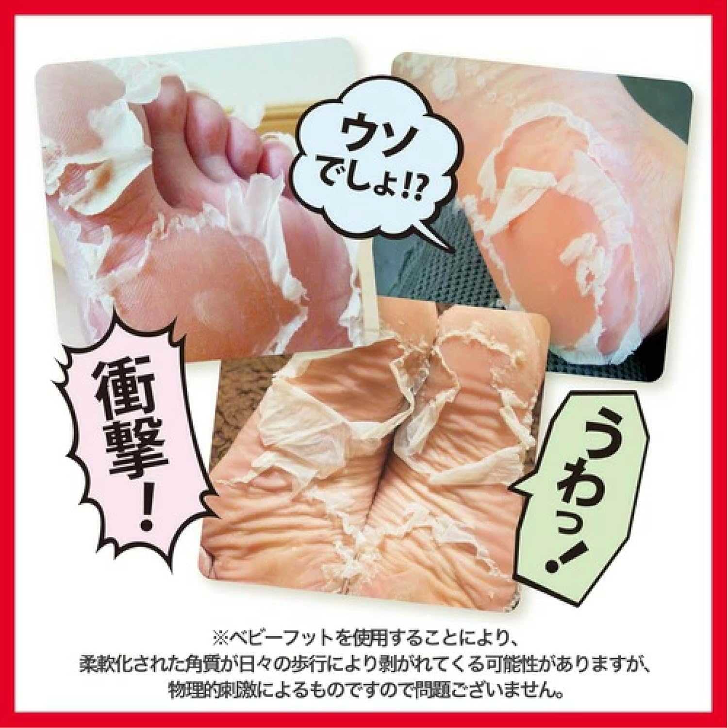 มาร์คที่ใช่แค่ 30 นาทีเท้าเนียนนุ่มแล้ว! Hello Kitty X Baby Foot Easy Pack