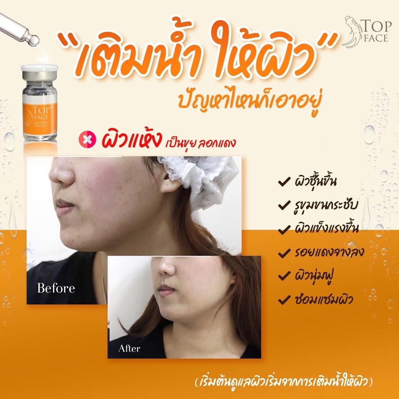 Top face