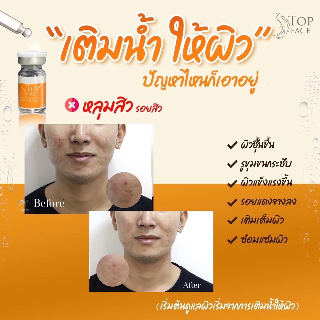 Top face
